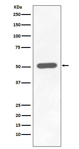 Phospho-Chk1 (S296) (14A3) Rabbit Monoclonal Antibody