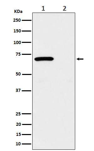 Phospho-Chk2 (T68) (17G19) Rabbit Monoclonal Antibody