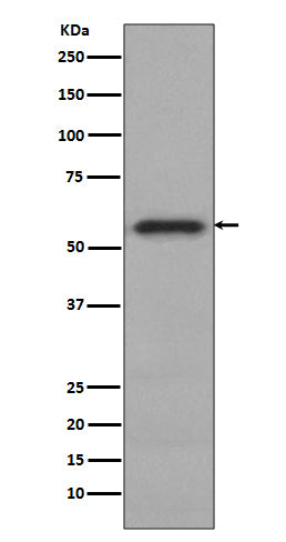 Phospho-c-Myc (S62) (9Z2) Rabbit Monoclonal Antibody