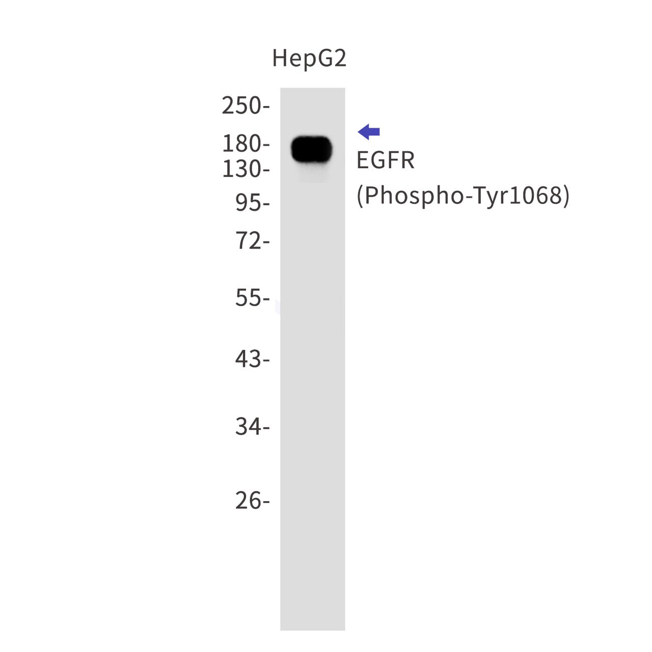 Phospho-EGFR (Tyr1068) (8F3) Rabbit Monoclonal Antibody