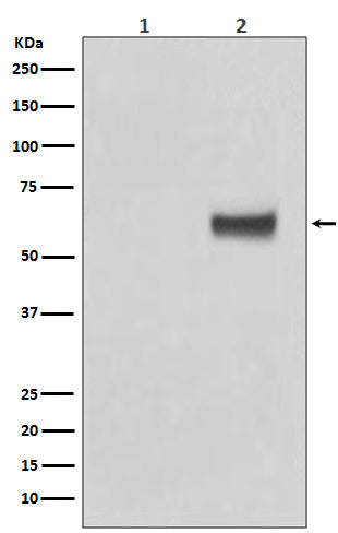 Phospho-ER alpha (S118) (6G16) Rabbit Monoclonal Antibody