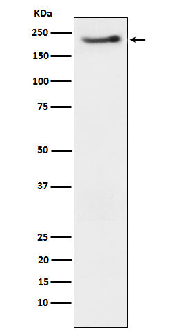Phospho-ErbB3 (Y1222) (11E17) Rabbit Monoclonal Antibody