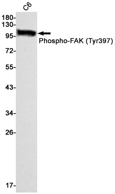 Phospho-FAK (Y397) (10H3) Rabbit Monoclonal Antibody