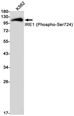 Phospho-IRE1 (S724) (4K17) Rabbit Monoclonal Antibody