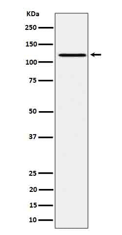Phospho-JAK1 (Y1034 + Y1035) (14S9) Rabbit Monoclonal Antibody