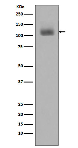 Phospho-JAK2 (Y1007 + Y1008) (17F11) Rabbit Monoclonal Antibody