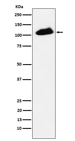 Phospho-KAP1 (S824) (13F9) Rabbit Monoclonal Antibody