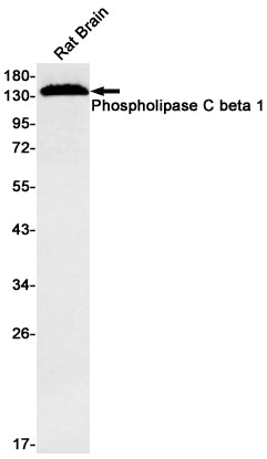 Phospholipase C beta 1 (8Q13) Rabbit Monoclonal Antibody