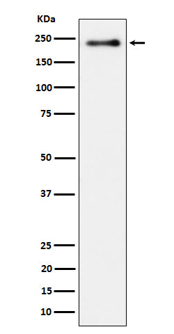 Phospho-LRP6 (S1490) (10R3) Rabbit Monoclonal Antibody