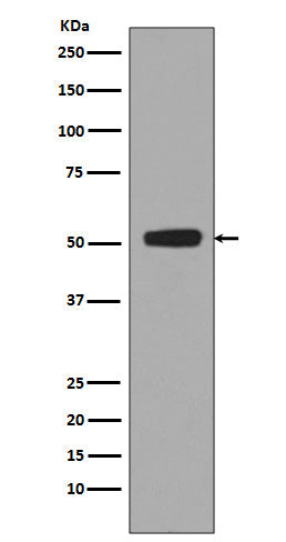 Phospho-p53 (S376) (15J12) Rabbit Monoclonal Antibody