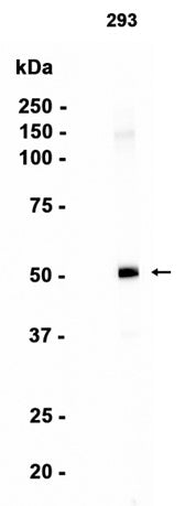 Phospho-p53 (S392) (9G13) Rabbit Monoclonal Antibody