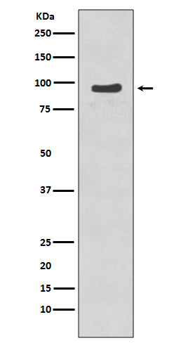 Phospho-p95/NBS1 (S343) (8Q6) Rabbit Monoclonal Antibody
