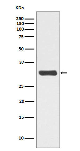 Phospho-RPA2 (T21) (8Y1) Rabbit Monoclonal Antibody