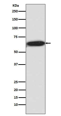 Phospho-S6K1 (T421 + S424) (1L11) Rabbit Monoclonal Antibody