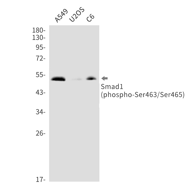 Phospho-Smad1 (Ser463/Ser465) (13F8) Rabbit Monoclonal Antibody