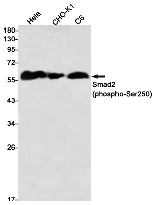 Phospho-Smad2 (S255) (16D10) Rabbit Monoclonal Antibody