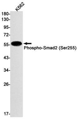 Phospho-Smad2 (Ser255) (9W3) Rabbit Monoclonal Antibody