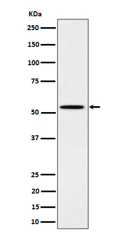 Phospho-Src (Y529) (9B14) Rabbit Monoclonal Antibody