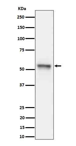 Phospho-Tau (S199) (9I10) Rabbit Monoclonal Antibody