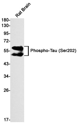Phospho-Tau (S202) (2Z4) Rabbit Monoclonal Antibody
