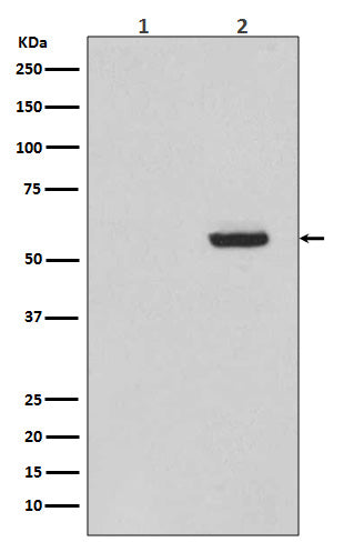Phospho-Tau (S396) (3K16) Rabbit Monoclonal Antibody