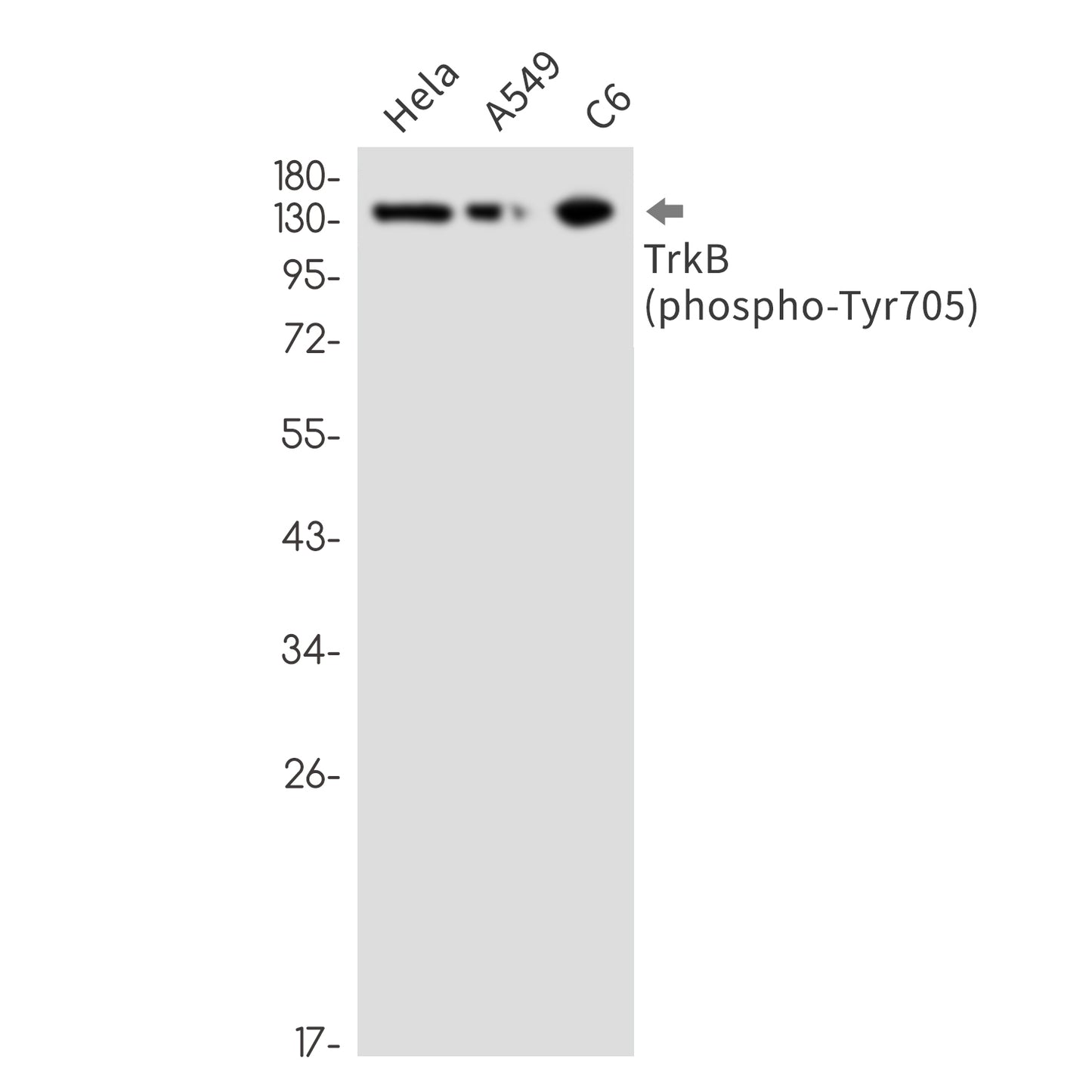 Phospho-TrkB (Tyr705) (3T18) Rabbit Monoclonal Antibody