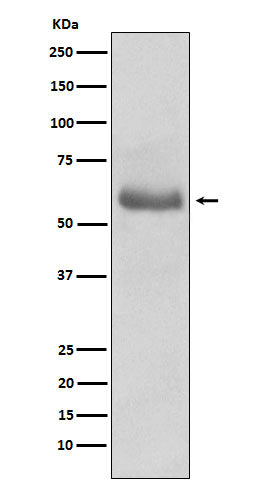 45567(17N4) Rabbit Monoclonal Antibody