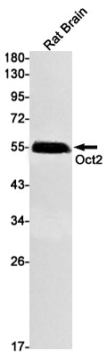45567(3A2) Rabbit Monoclonal Antibody