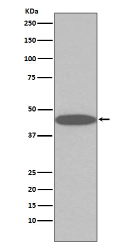 45569(2Y12) Rabbit Monoclonal Antibody