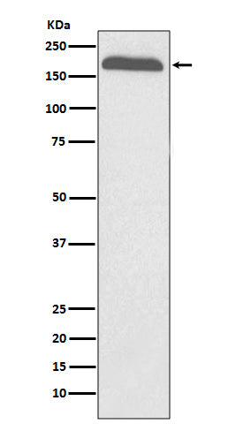 A2M (2T11) Rabbit Monoclonal Antibody