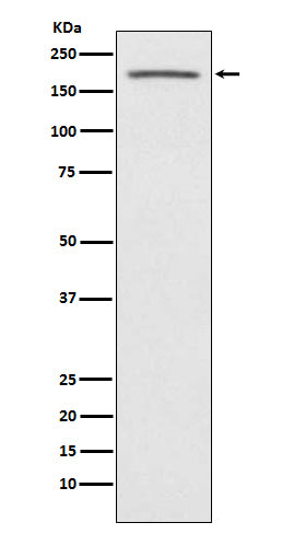 ACE1 (17Q3) Rabbit Monoclonal Antibody