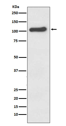 ACE2 (9T7) Rabbit Monoclonal Antibody