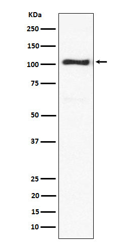 ACTN3 (19N12) Rabbit Monoclonal Antibody