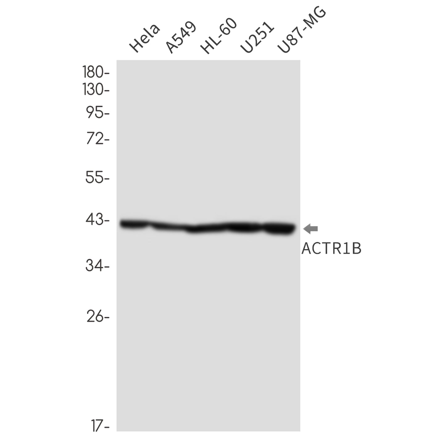ACTR1B (17O10) Rabbit Monoclonal Antibody