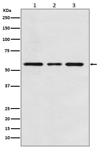 ACVRL1 (9G1) Rabbit Monoclonal Antibody
