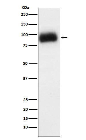 ADAM15 (11M11) Rabbit Monoclonal Antibody