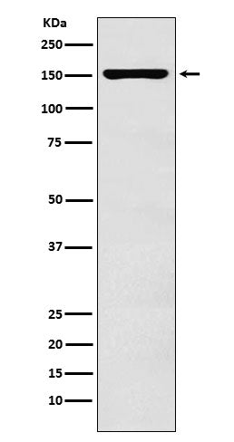 ADAR1 (16R16) Rabbit Monoclonal Antibody