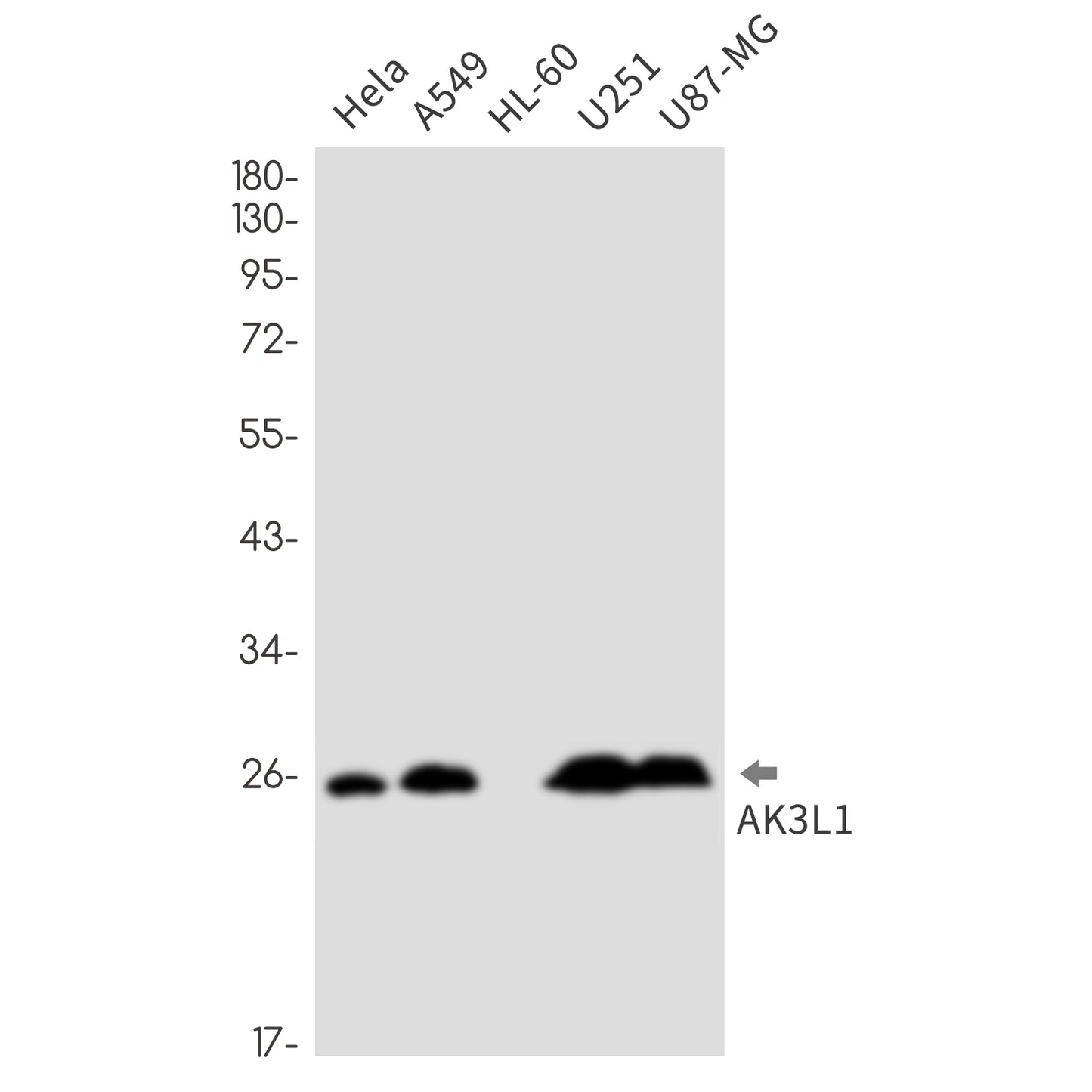 Adenylate kinase 4 (14Y15) Rabbit Monoclonal Antibody