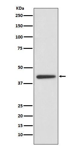 ADIPOR1 (12R16) Rabbit Monoclonal Antibody