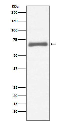 AFP (1J18) Rabbit Monoclonal Antibody