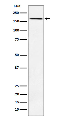 AGL (5T19) Rabbit Monoclonal Antibody