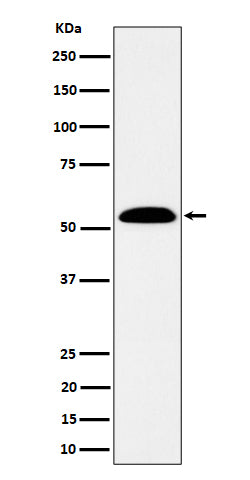 ALDH7A1 (14K11) Rabbit Monoclonal Antibody