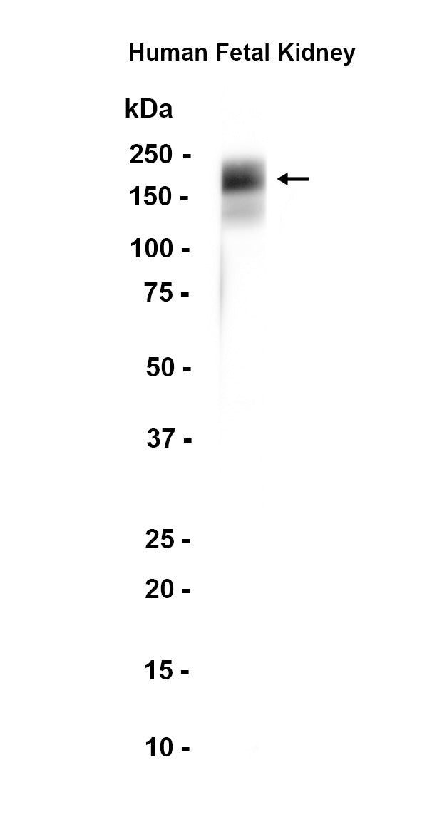 Aminopeptidase A / CD249 (19X10) Rabbit Monoclonal Antibody