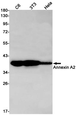 Annexin A2 (5A11) Rabbit Monoclonal Antibody