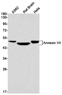 Annexin A7 (11B18) Rabbit Monoclonal Antibody