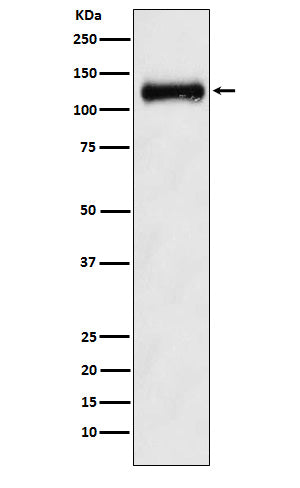 ANPRB (6S5) Rabbit Monoclonal Antibody