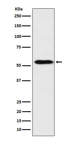 ApoH (4D12) Rabbit Monoclonal Antibody