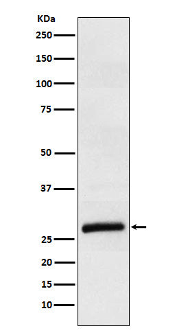 ApoM (11W2) Rabbit Monoclonal Antibody