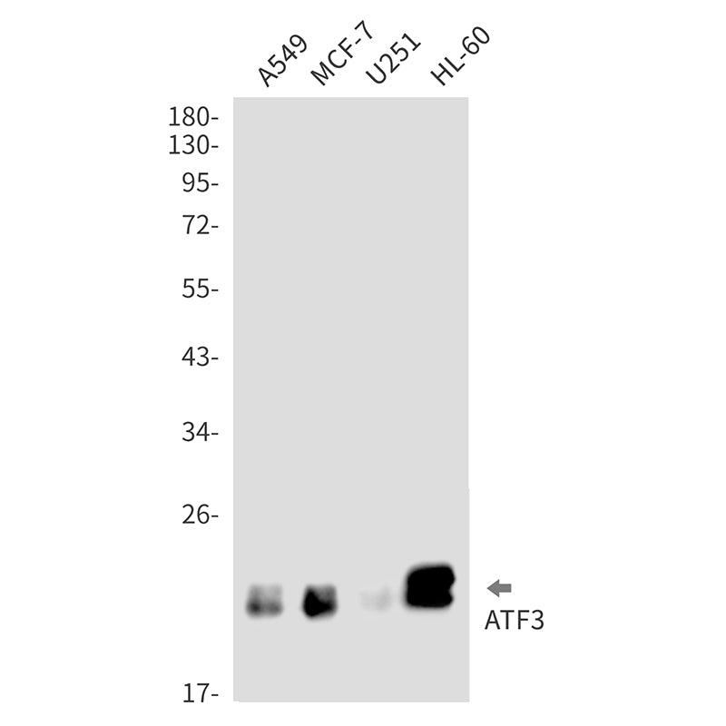ATF3 (19R19) Rabbit Monoclonal Antibody