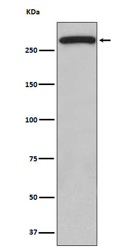 ATM (2G7) Rabbit Monoclonal Antibody